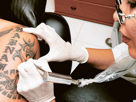 Providing tattoo services in guise of body art is illegal | Health – Gulf  News