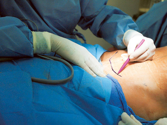 Tummy Tuck Surgery in Kerala, India