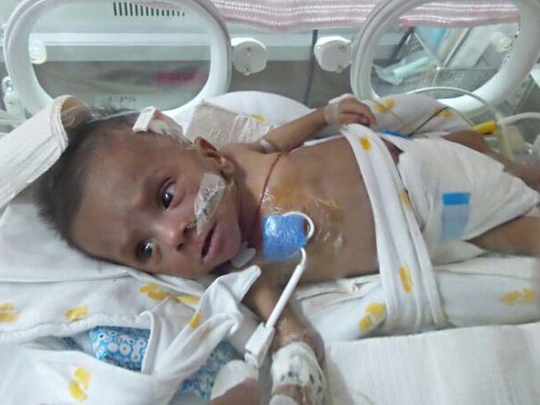 Baby Safa’s Plight Moves Readers To Help 