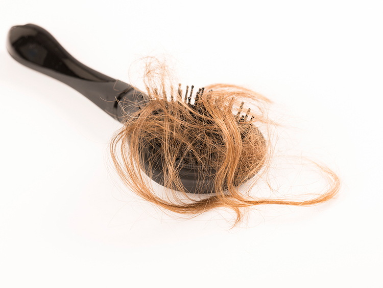 How to stop this hair loss?' | Community – Gulf News