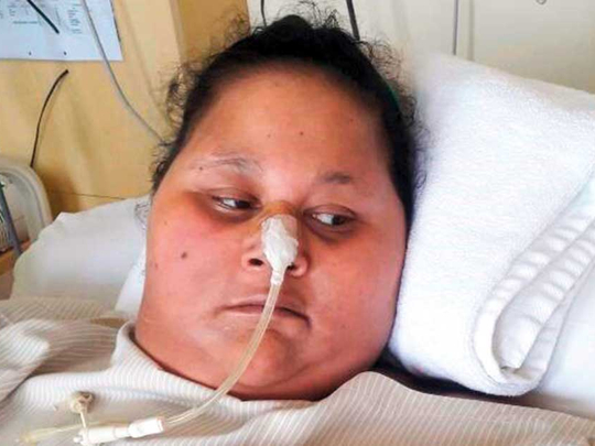 Worlds Heaviest Woman To Arrive In Uae On Thursday Health Gulf News 