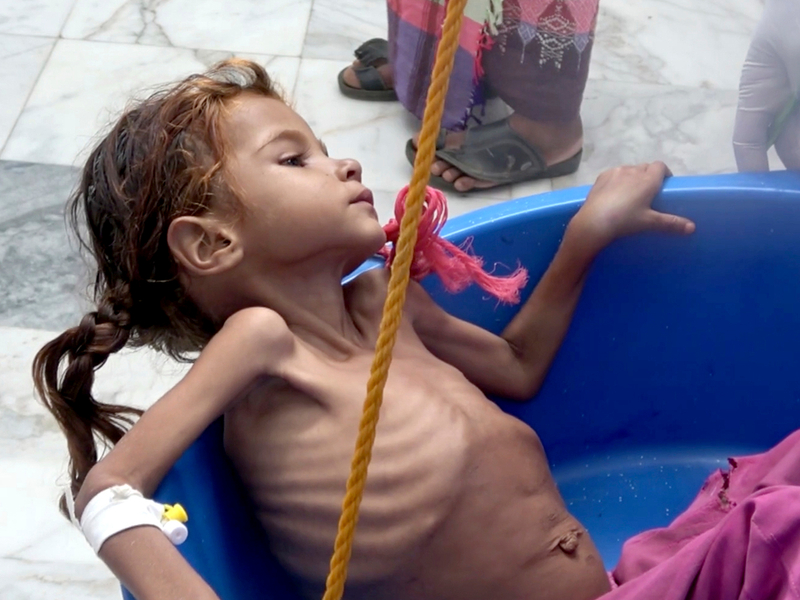 20181109_Famine_Yemen