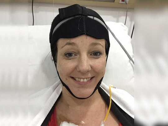 Cold caps may help cancer patients keep their hair