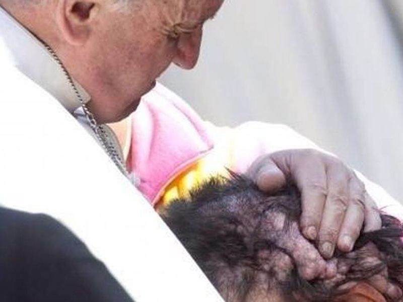 Pope disfigured man