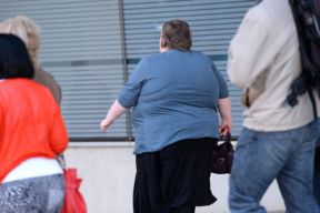 OPN An obese person-1566646346809