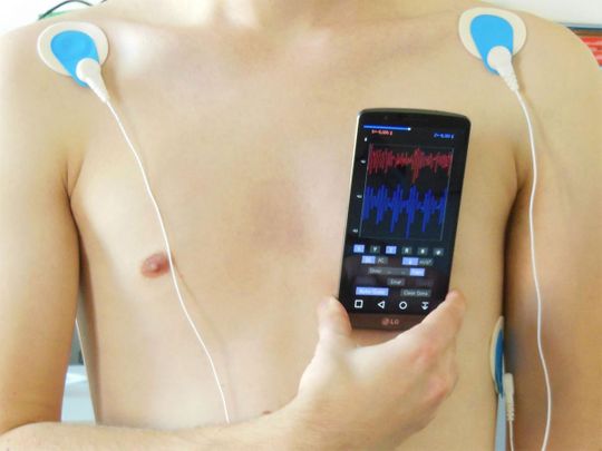 Smart phone as a health monitoring device