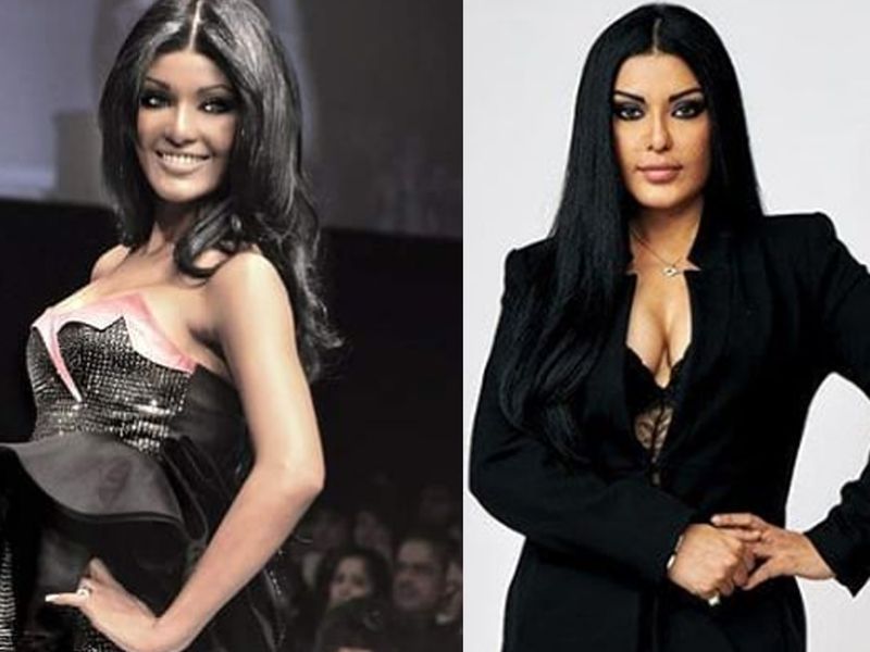 Celebrities who have undergone plastic surgery 