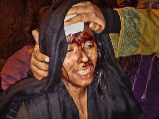  JNUSU President Aishe Ghosh is seen injured after being attacked at JNU