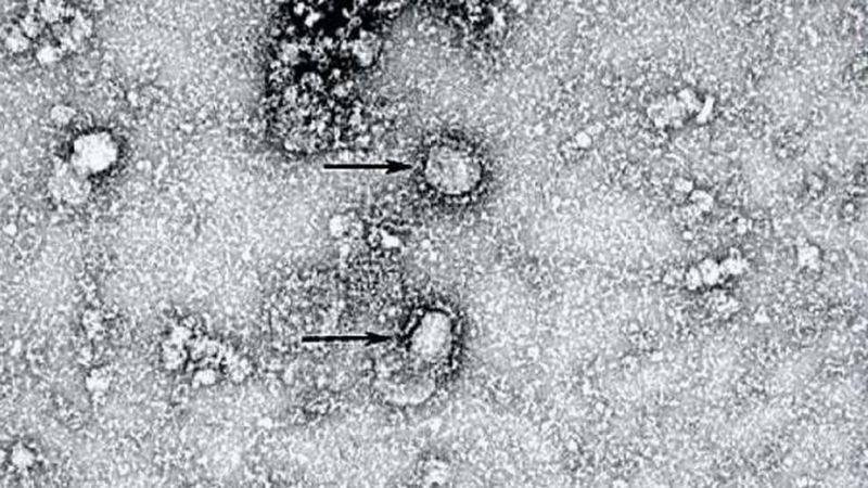 novel coronavirus strain