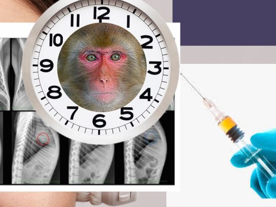 Is Covid 19 Reinfection Possible What A Study On Monkeys Shows Special Reports Gulf News