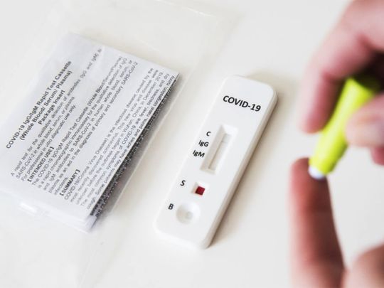 An at-home COVID-19 antibody rapid test cassette. Bloomberg