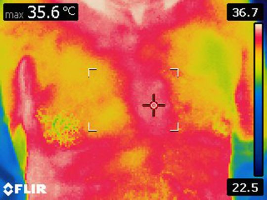 NAT Thermal Imaging Using the Platfornm 1-1592634269615