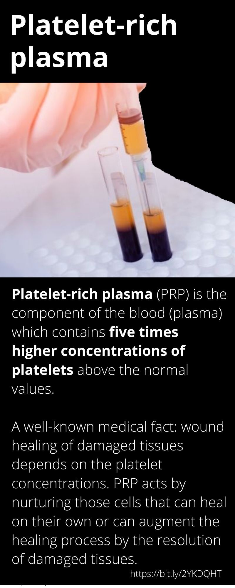 Platelet rich plasma