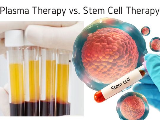 Stem cell vs plasma