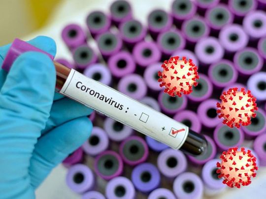 UAE reports 2,015 new coronavirus cases, 2 deaths | Health – Gulf News