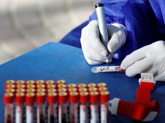 Pakistan blood test pandemic coronavirus