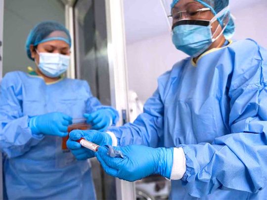UAE reports 2,629 new coronavirus cases, 5 deaths | Health – Gulf News