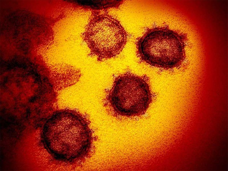 20201118 coronavirus