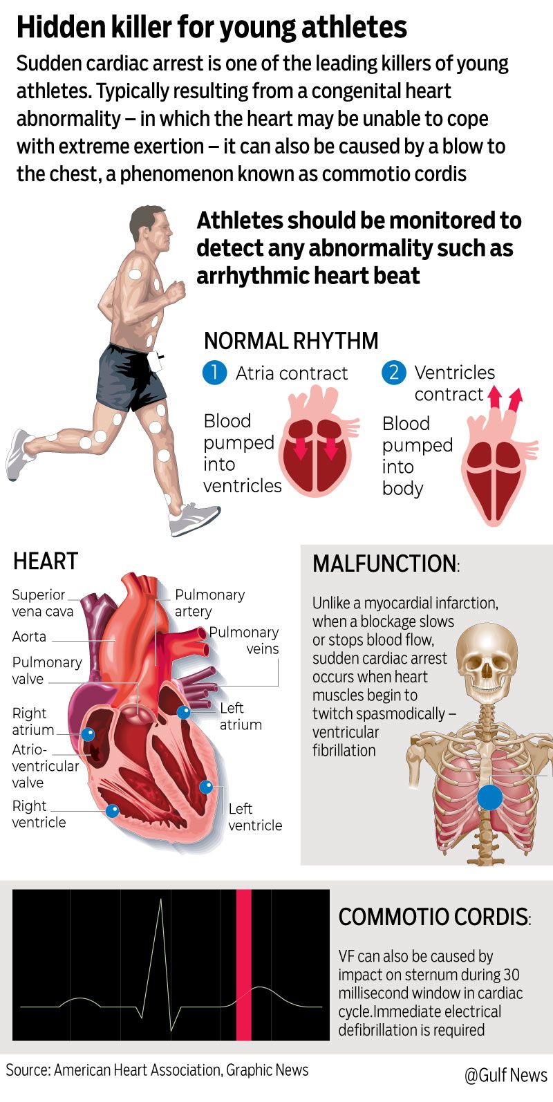 Graphic athletes heart attack