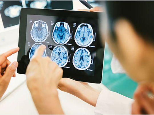 MRI may predict intelligence level in children
