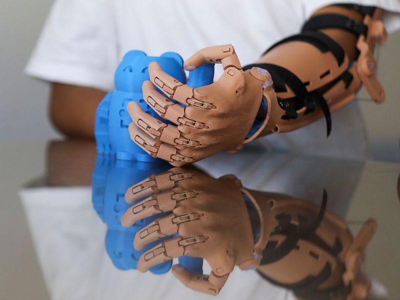 3D-printed prosthetic arms