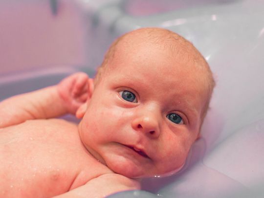 Delay in clamping umbilical cord benefits babies, U.S. doctors say
