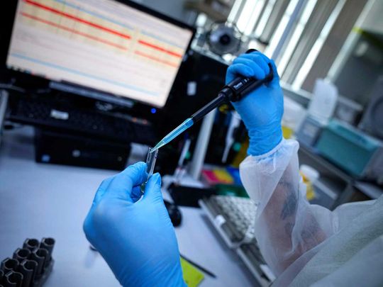Russia antibody test laboratory
