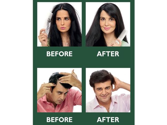 Kesh King Natural Hair Oil: India’s no.1 hair fall professional