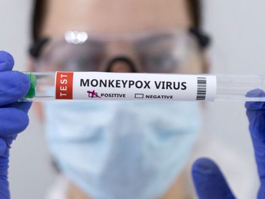monkeypox-24-1653381956344