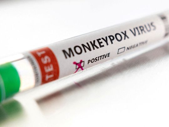 20220529 monkeypox uae