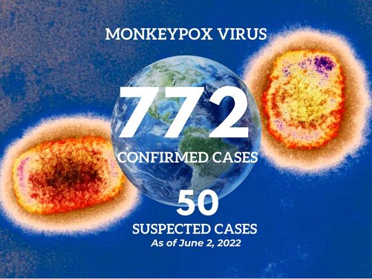 Monkey pox June 2, 2022, 7pm UAE time