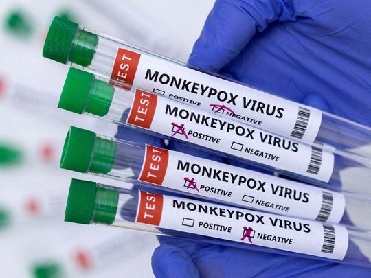 20220630 monkeypox