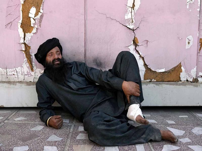 A Sikh man who was wounded by an explosion sits on the ground at the site in front of a Sikh temple in Kabul. 