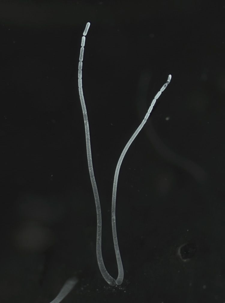 Filaments of a Thiomargarita magnifica bacteria cell.  