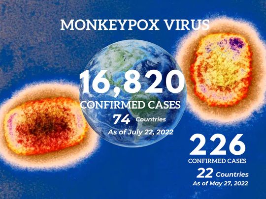 monkeypox july 22 2022