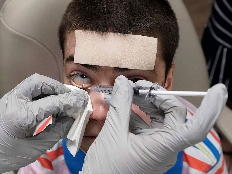 Dr. Alfonso Sabater, uses a syringe to apply gene therapy eyedrops to Antonio Vento Carvajal's eyes, at University of Miami Health System's Bascom Palmer Eye Institute in Miami. 
