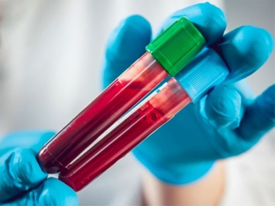 Simple blood test may predict future heart, kidney risk for diabetics
