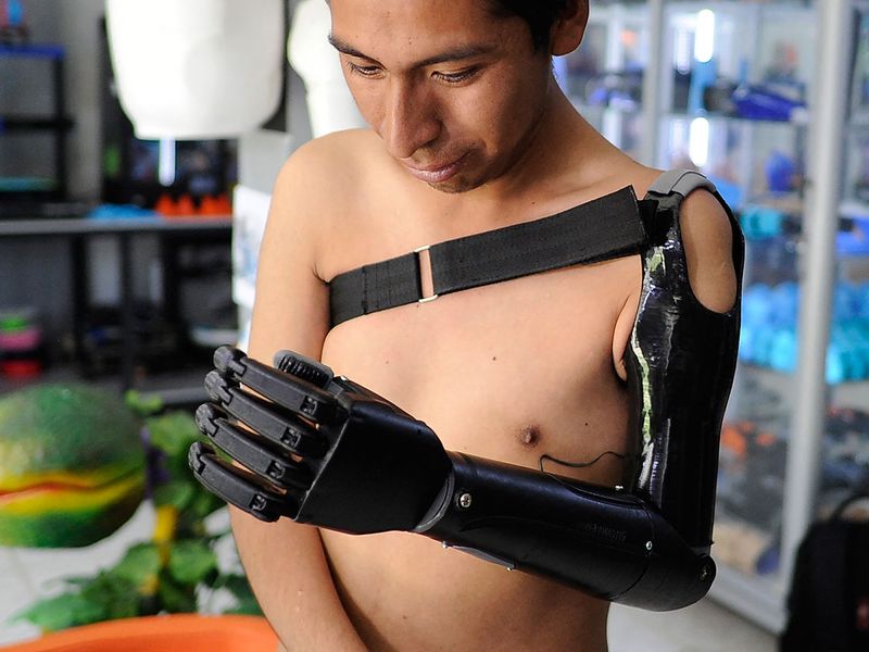 ROBOTIC-PROSTHESIS gallery