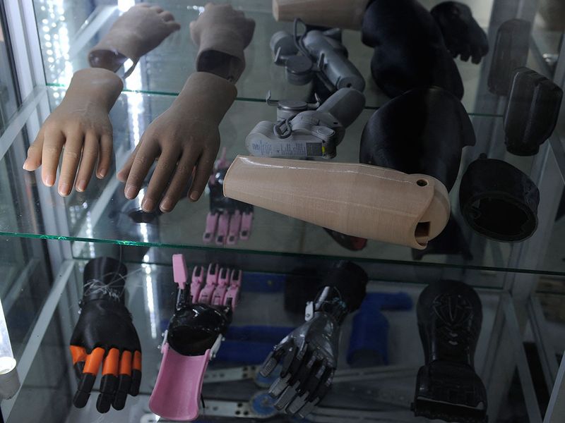 ROBOTIC-PROSTHESIS gallery