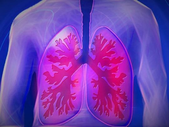 lungs_16f7ff5087b_large-1709876119521