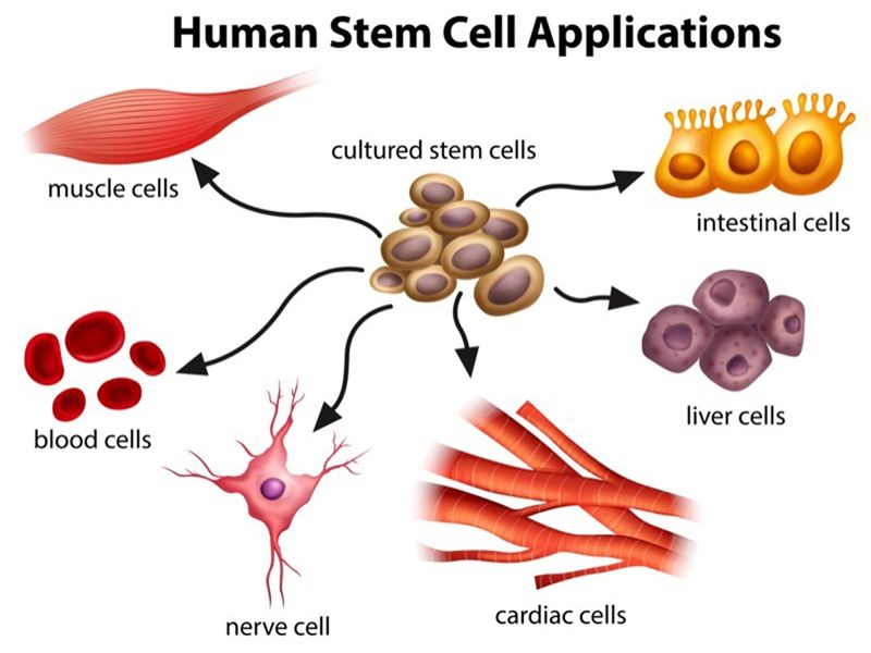 cord blood stem cell banking