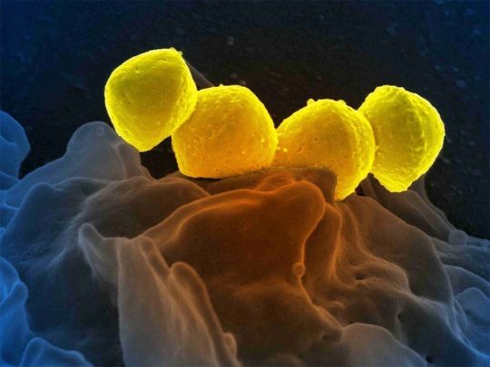 Scanning electron micrograph of Group A Streptococcus (Streptococcus pyogenes) bacteria. 