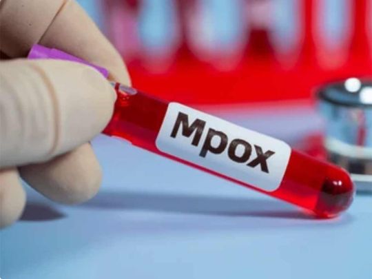 STOCK mpox